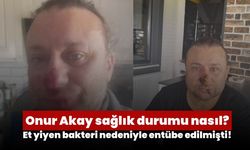 Onur Akay sağlık durumu nasıl? Et yiyen bakteri nedeniyle entübe edilmişti!