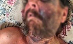 "Abimin cenazesine neden gelmedin" diyerek dövüp ölüme terk etmişler