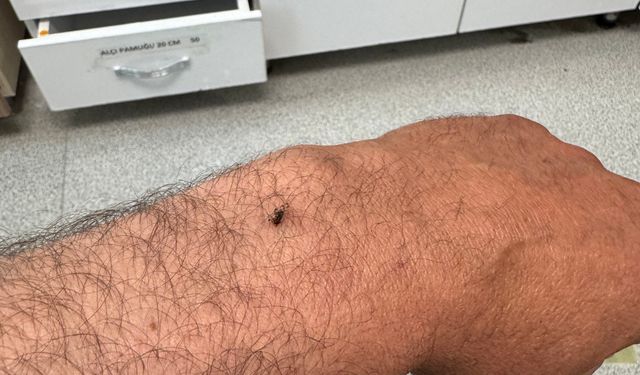 İtfaiye erinin koluna yapışan kene hastanede çıkarıldı