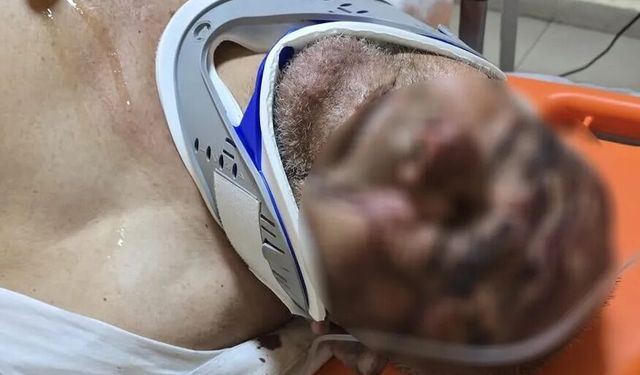 Çanakkale’de akılalmaz olay! 150 bardak çay borcu için 70 yaşındaki adamı dövdü