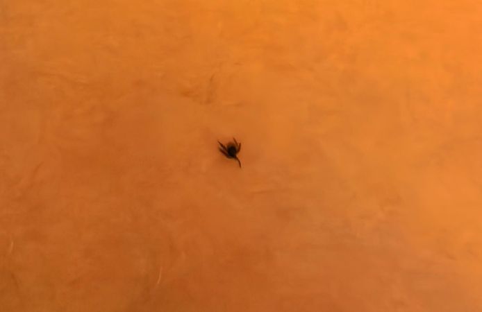7 yaşındaki çocuğun göğsüne kene yapıştı