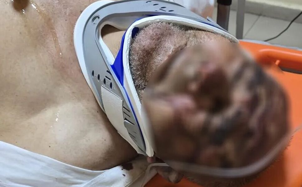 Çanakkale’de akılalmaz olay! 150 bardak çay borcu için 70 yaşındaki adamı dövdü